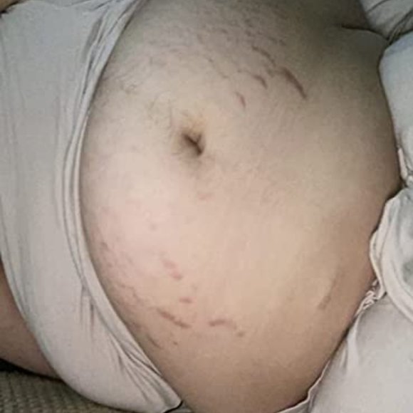 Bio Oil - Picture 6 of 10